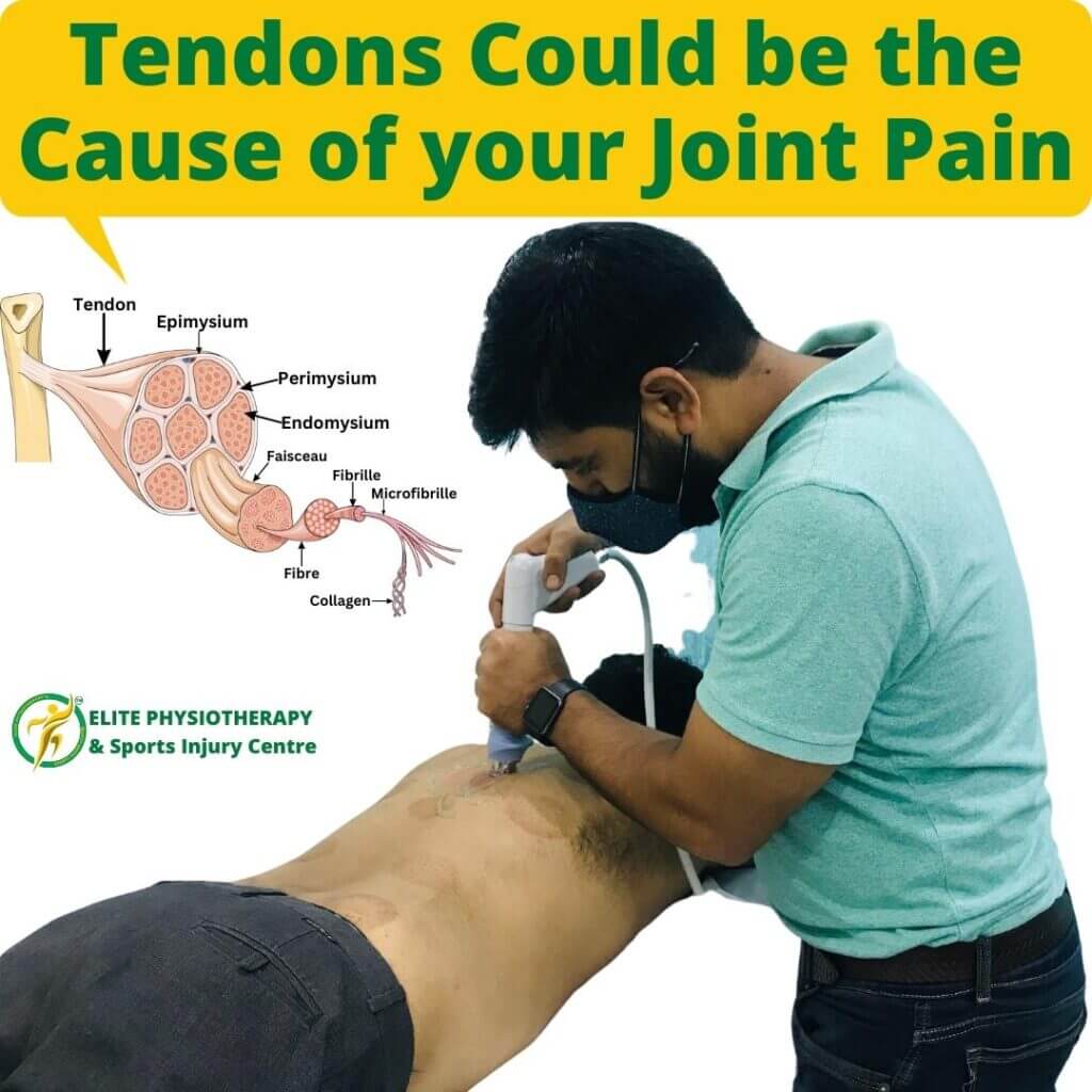 Tendons Could be the Cause of your Joint Pain