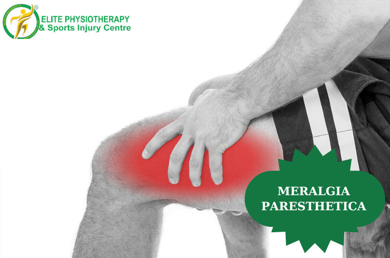 Meralgia Paresthetica Elite Physio Therapy