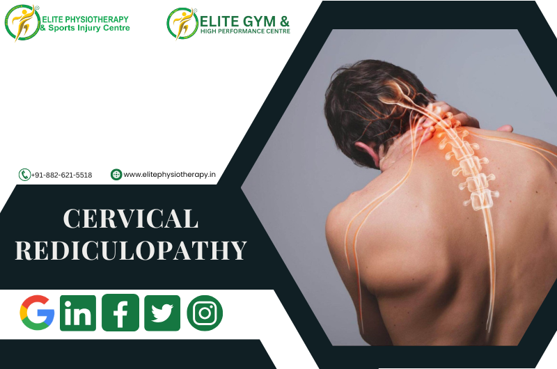 CERVICAL REDICULOPATHY