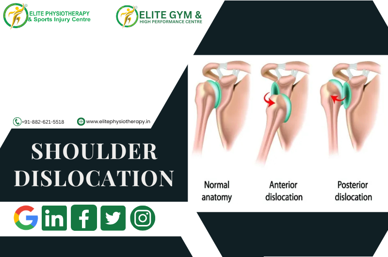 SHOULDER DISLOCATION