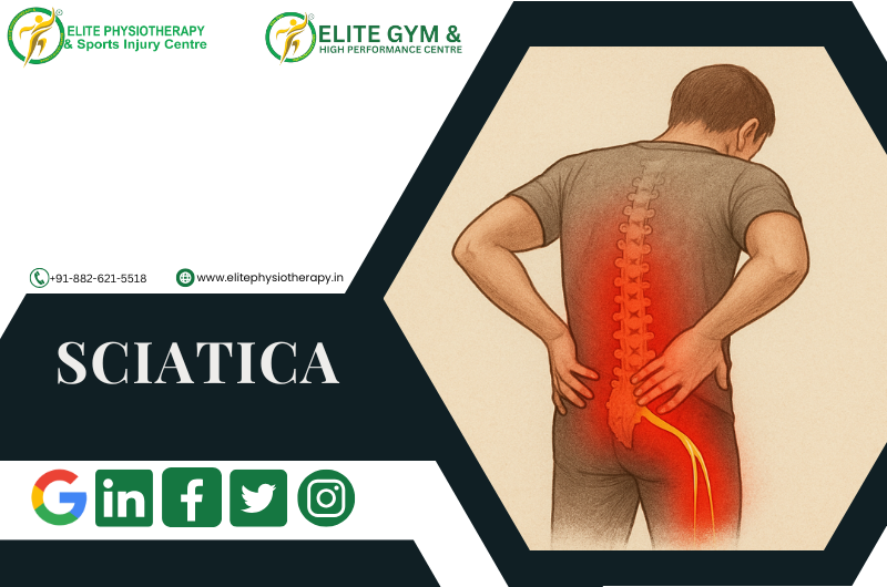 Sciatica – Culprit for your long running lower back pain