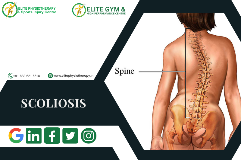 Scoliosis and its management strategies