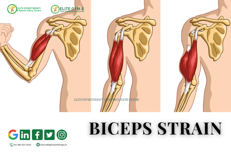 Biceps Strain and Anterior Elbow Pain