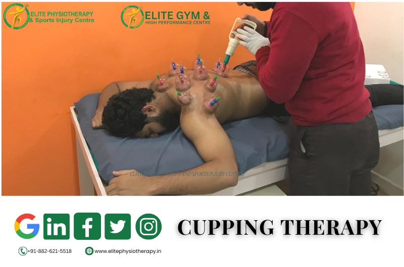 CUPPING THERAPY