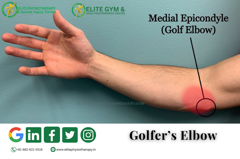 Golfer’s Elbow (Medial Epicondylitis) and its Best Treatment