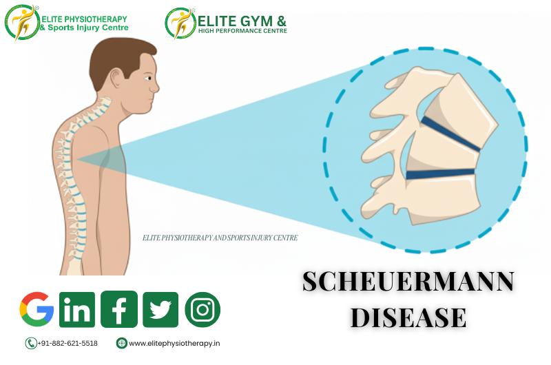 Scheuermann Disease/Kyphosis and its Management