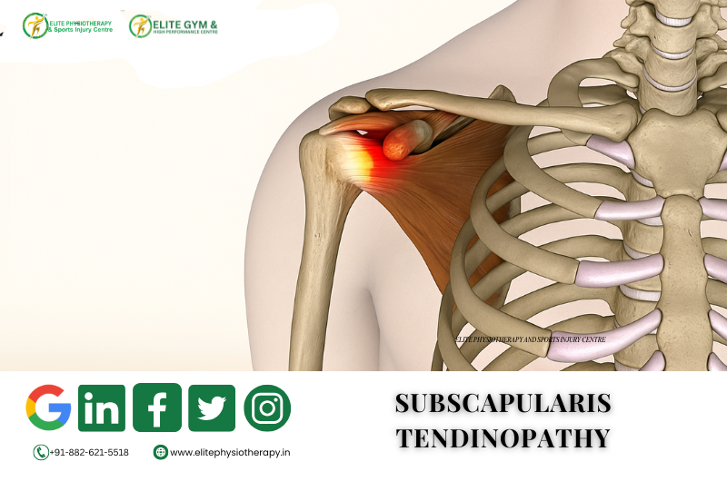 SUBSCAPULARIS TENDINOPATHY