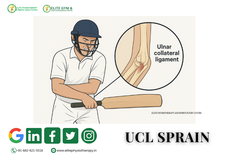 UCL Sprain: Modern Treatment, Better Recovery