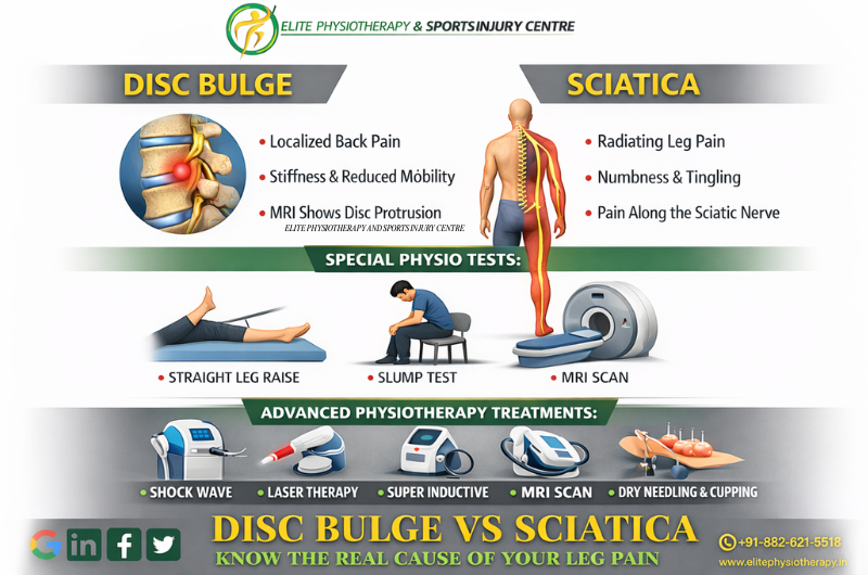 Disc Bulge vs Sciatica: Know the Real Cause of Your Leg Pain