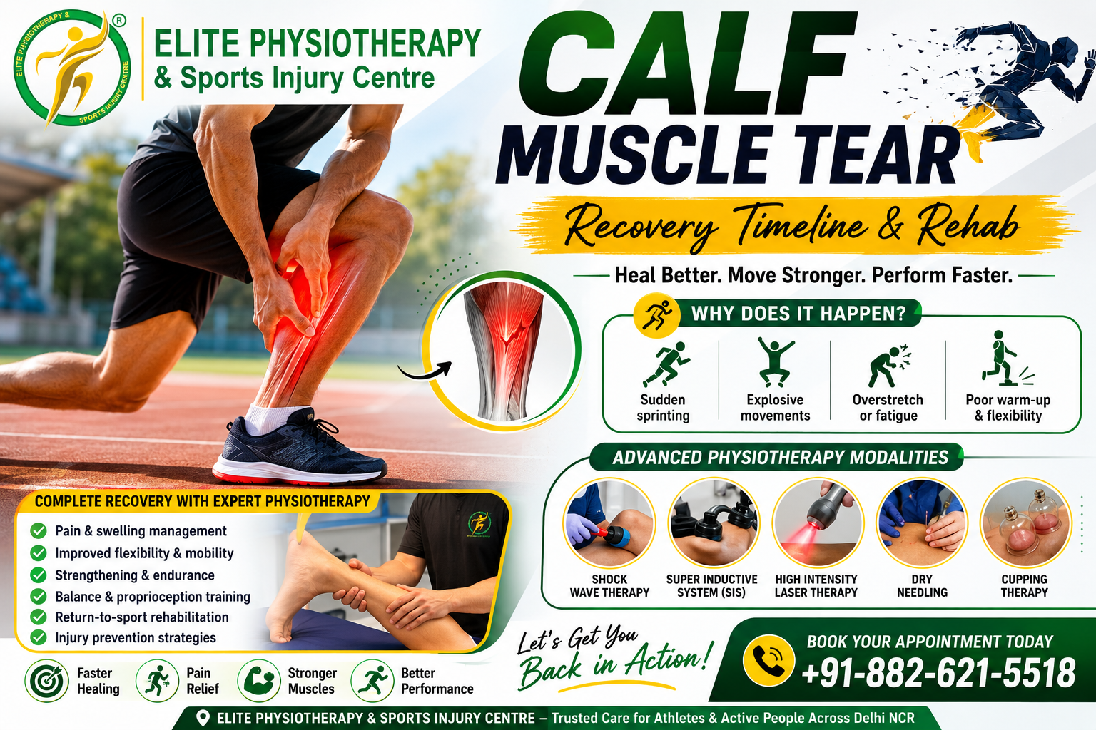 Calf Muscle Tear Recovery