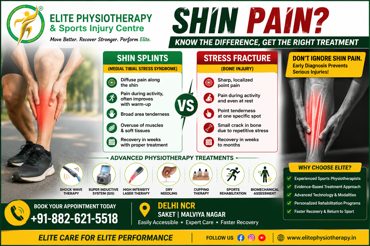 Shin Splints vs Stress Fracture